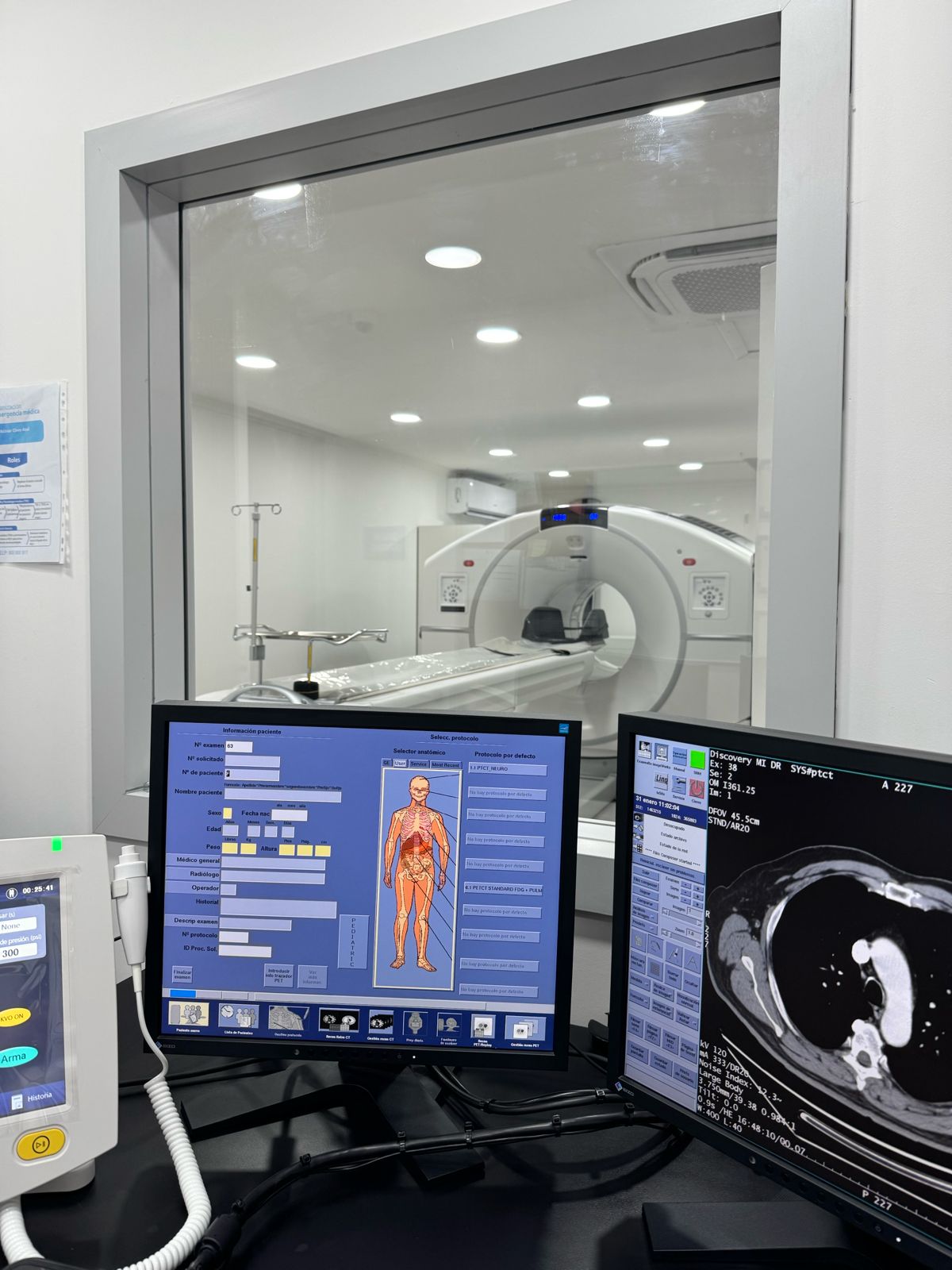 Diferencias entre un PET-CT y un TAC